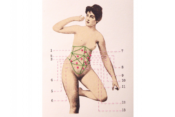 Localization of Organs Producing Pain by Fabulous Cat Papers