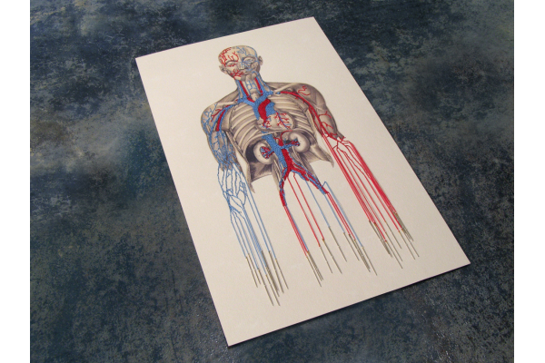 Bleeding by Needles by Fabulous Cat Papers
