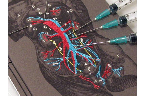 Dissection of a Male Torso Journal by Fabulous Cat Papers